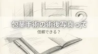 包茎手術の術後写真って信頼できる？